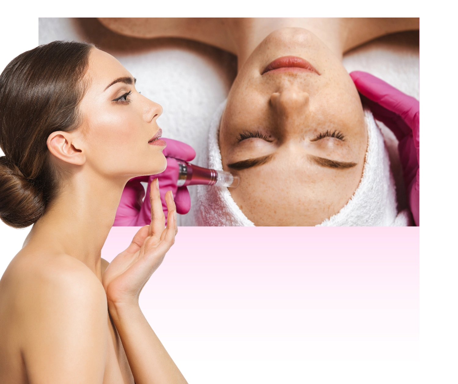 RATENZAHLER - Kosmetik & Ästhetik - Microneedling