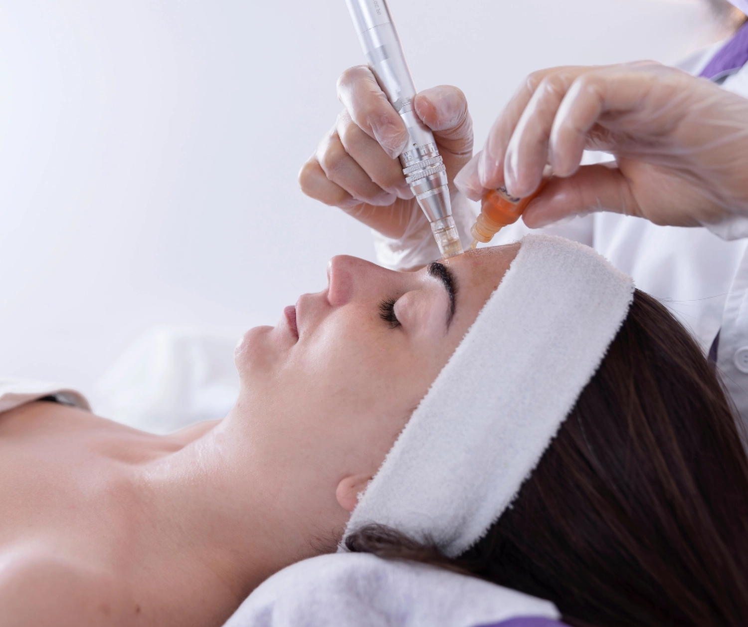 RATENZAHLER - Kosmetik & Ästhetik - Microneedling